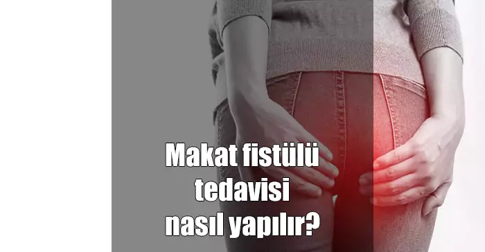 anal fistül tedavisi